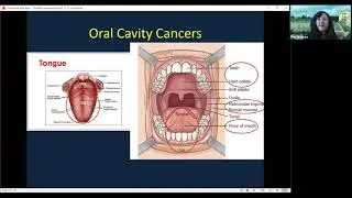 Head /Neck and Thyroid Cancers