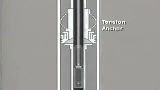tubing anchor