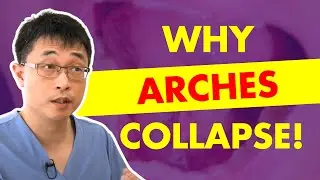 Live Q&A: Why Your Arch Collapses After Expansion — The REAL Cause!