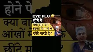 Is it right to wash eyes during Conjunctivitis?