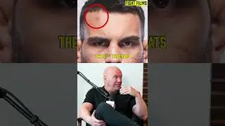 Dana on What's Really Going on with Askren #shorts #danawhite #ufc #benaskren #staph #fight #fighter