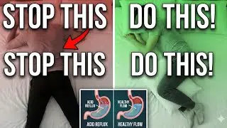 Stop Sleeping Like This! How Your Position Affects Your Health ❌✅