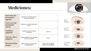 Anatomía en Oculoplástica