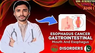 Esophageal Cancer | Gastrointestinal Disorders | Adult Health Nursing-I | BSN 3rd Semester | Unit-I