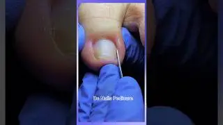 Beautiful Nails satisfying pedicure #nails #satisfying #pedicure #shorts