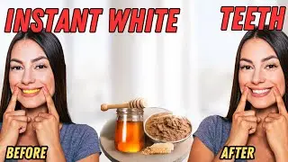 MAGIC Herbal Teeth Whitening Paste | 100% Natural | Instant White Teeth at Home (No Chemicals!)