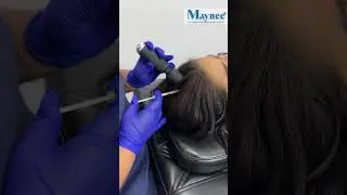 Nithya Ram | Hair treatments | Maynee Cosmetology Clinic