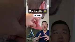 Acupuncture & Muscle Knots&mdash;What&rsquo;s the Deal? 🎯
