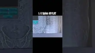 L/S Spine AP/LAT #anatomy #hospital #xray #radiology