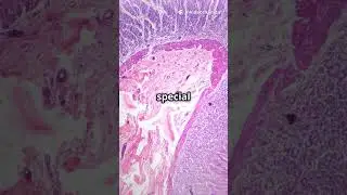 The acid on your stomach can dissolve metal# stomach #facts #acidente