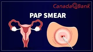 Pap Smear: Cervical Cancer Screening Explained | Indications, Results & Guidelines | CanadaQBank