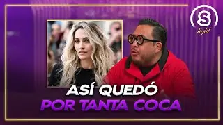 Paris Jackson shows off her new nose | MLDA