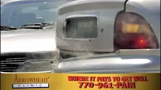 Atlanta Personal Injury Chiropractor | Car Accident Doctor