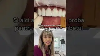 FATETE DENTARE | AI NEVOIE?!