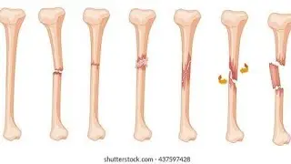 # structure of bone #structure of cartilage #human skeleton #osteoan #chondrocyte #shabirkhan hindi