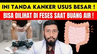 Gejala Kanker Usus yang Bisa Dilihat di Kotoran: Tanda yang Tak Boleh Diabaikan!