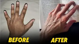 Korean Veiny Hands Exercise