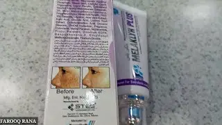 MELAKLYR PLUS CREAM REVIEW /MELASMA , PIGMENTATION,FRECKLES ISSUE REAOLVE @farooqrana097