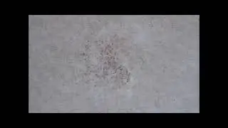 HS dogdz microfilaria close