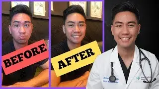 How to Stop Asian Glow / Stop Asian Flush