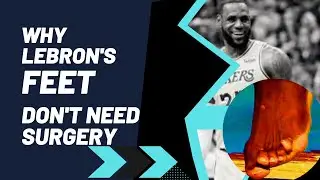 Why Lebron James Feet Don't Need Surgery | Hyperarch Fascia Training