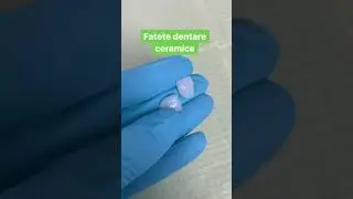 Fatete ceramice individuale
