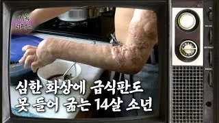 ['가족' 레전드 14편③] 심한 화상에 급식판도 못 들어 굶는 14살 소년