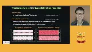 OHBM 2019 | Oral Sessions | Machine - learning Predictions of Stroke Recovery Using Quantitati&hellip;