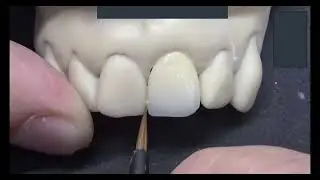Biomic Stain & Glaze: Elevate Your Esthetics - Presented by Aidite & Nowak Dental Supplies
