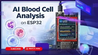 BIOScreen | AI-Integrated Embedded System for Real-Time Blood Cell Classification (FYP Project)