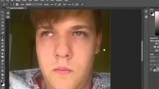 Ugly to pretty [Photoshop tutorial]