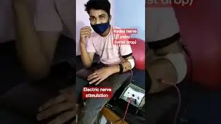 Radial nerve stimulation #physiotherapy #wristdrop #palsy #stimulus