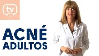 C&oacute;mo tratar el acn&eacute; del adulto