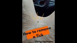 How to remove a Tick (with tweezers).