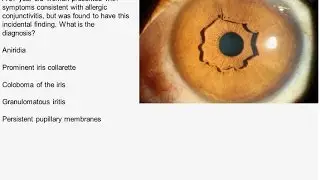Charit&eacute; Clinical Journal Club by Fred Luft - 15.03.2017