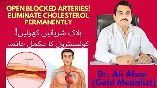 Cholesterol Homeopathic Treatment|Open Blocked Arteries & Eliminate Cholesterol Permanently|
