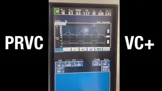 PRVC and VC+ mode on ventilator
