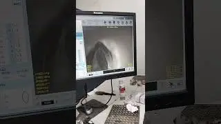 Fancy diamond cutting process #new #viral #diamond #youtubeshorts #youtube #blogger #vlog 