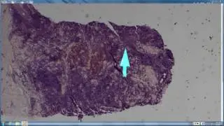 2016 2017 Elston Dermpath Ch 25