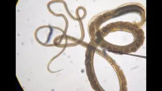 This Worm Lives in Your Gut?😳 Microscopic View of Trichuris trichiura #parasite #parasitology