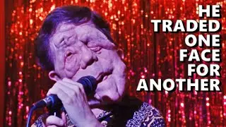 He Traded One Face For Another - A Different Man