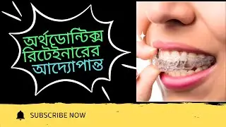 অর্থডোন্টিক্স রিটেইনারের আদ্যোপান্ত। অর্থডোন্টিক্স রিটেইনার। Orthodontic Retainer। Clear Retainers। 