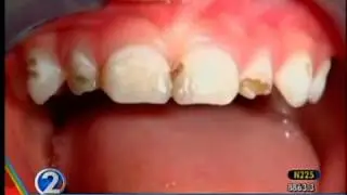 10-8-12 Ask A Specialist- Dr. Hollander