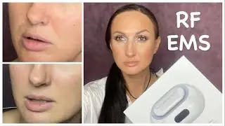 Как Продлить Молодость Кожи /RF, EMS Iluminage Youth Activator Pro
