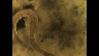 Moster worm#aquarium #microscope #microscopicview #aquascape #microscopic #biology #science