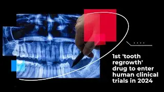 1st 'tooth regrowth' drug to enter human clinical trials in 2024