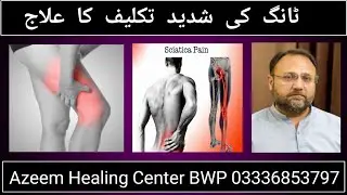 Leg Pain | Sciatica | Azeem Healing Center | Hafiz Khalid Hussain | 03336853797