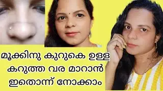How to reduce Black line on Nose👃|Dark line across the Nose | Home remedy fast result |Aan Aan style