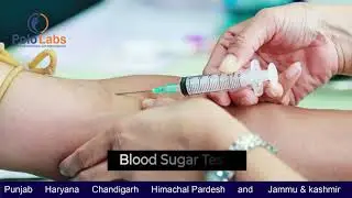 Healthcare Video | Pathology tests | Coronavirus |Health awareness videos | Explanatory | 7506203777