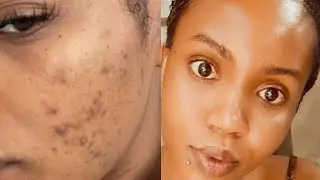 DOUBLE CLEANSING -HOW TO REMOVE MAKE-UP TO AVOID BREAKOUTS.